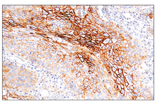 Immunohistochemistry Image 2: CD54/ICAM-1 (E3Q9N) XP® Rabbit mAb (BSA and Azide Free)