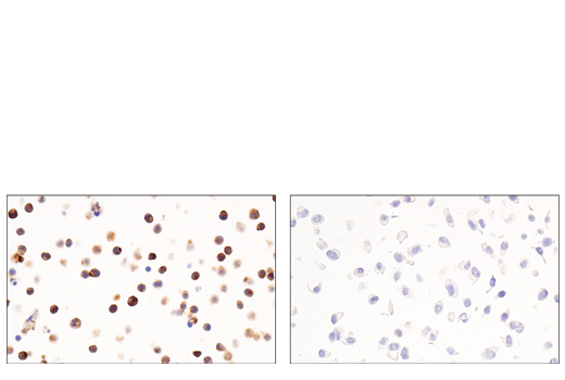 Immunohistochemistry Image 11: CD54/ICAM-1 (E3Q9N) XP® Rabbit mAb (BSA and Azide Free)