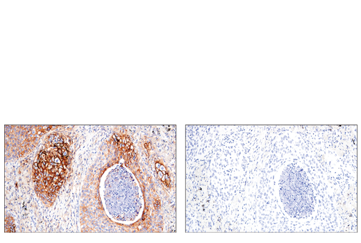 Immunohistochemistry Image 10: CD54/ICAM-1 (E3Q9N) XP® Rabbit mAb (BSA and Azide Free)