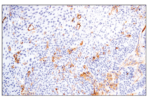 Immunohistochemistry Image 3: CD54/ICAM-1 (E3Q9N) XP® Rabbit mAb (BSA and Azide Free)