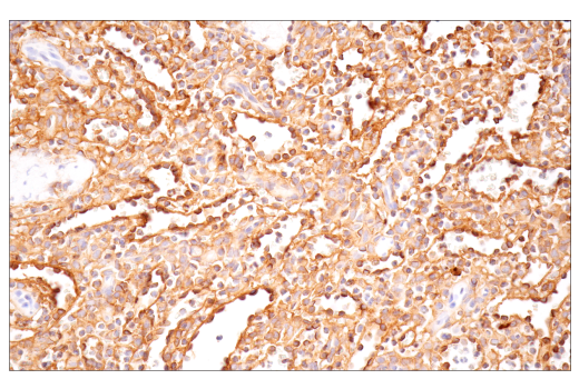 Immunohistochemistry Image 9: CD54/ICAM-1 (E3Q9N) XP® Rabbit mAb (BSA and Azide Free)