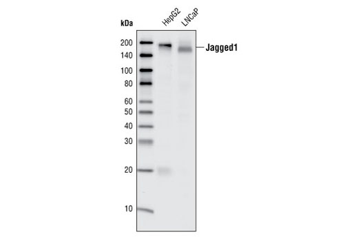  Image 5: Notch Receptor Interaction Antibody Sampler Kit