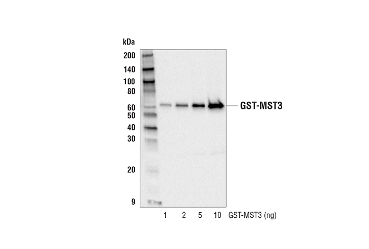 Western Blotting Image 2: GST-Tag (91G1) Rabbit mAb