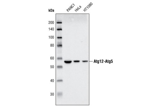 Western Blotting Image 1: Atg5 Antibody