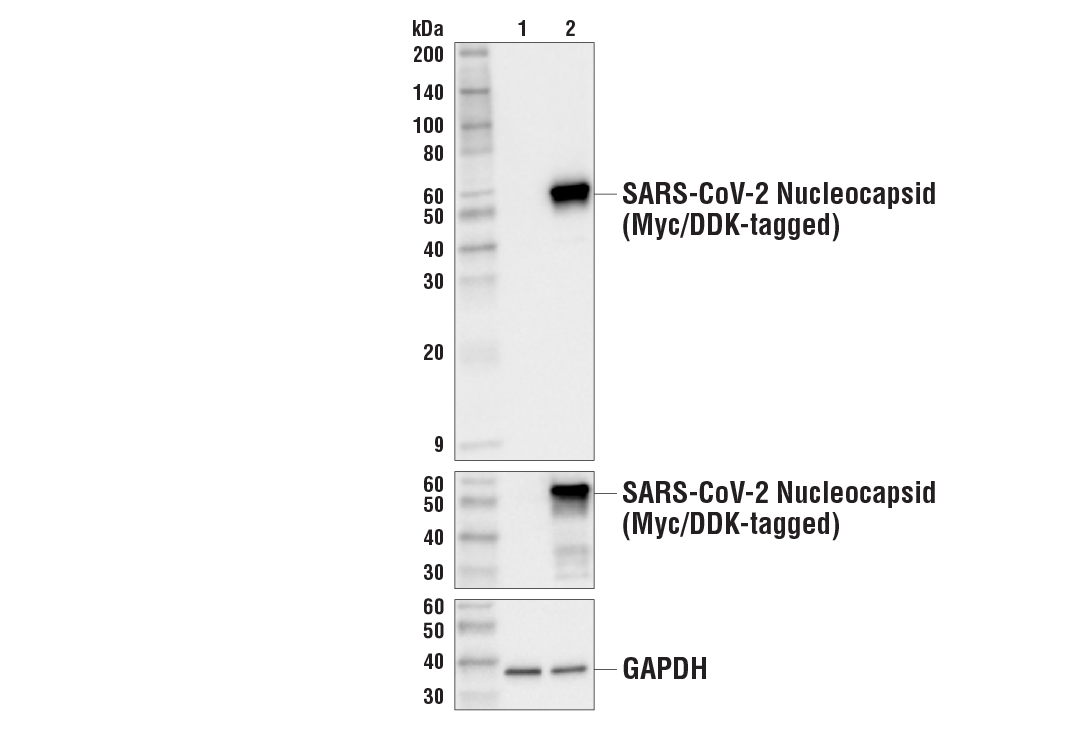 Western Blotting Image 1: SARS-CoV-2 Nucleocapsid Protein (HL344) Rabbit mAb