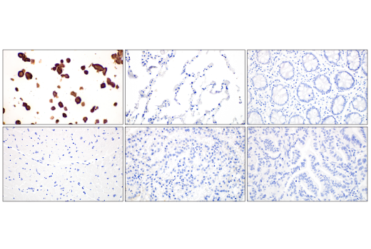 Immunohistochemistry Image 2: SARS-CoV-2 Nucleocapsid Protein (HL344) Rabbit mAb