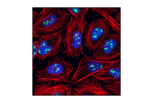  Image 18: Nucleus and Nuclear Envelope-Associated Marker Proteins Antibody Sampler Kit