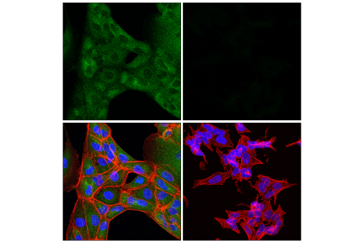 Immunofluorescence Image 1: MLKL (E7V4W) Mouse mAb