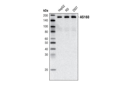  Image 2: AS160 Signaling Antibody Sampler Kit