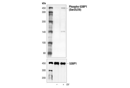 Phospho 53bp1 Ser2529 Antibody Cell Signaling Technology