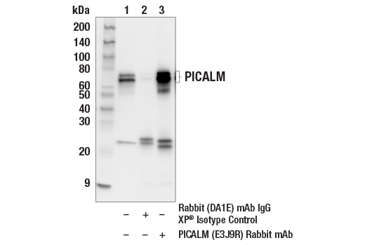 Immunoprecipitation Image 1: PICALM (E3J9R) Rabbit mAb