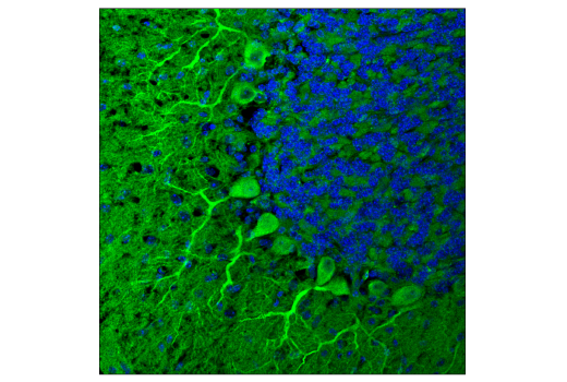 Immunofluorescence Image 1: PICALM (E3J9R) Rabbit mAb