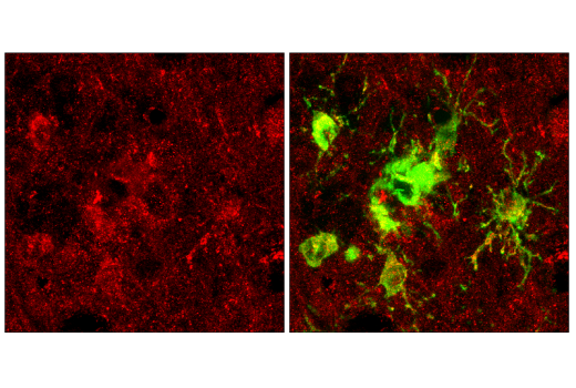 Immunofluorescence Image 2: PICALM (E3J9R) Rabbit mAb