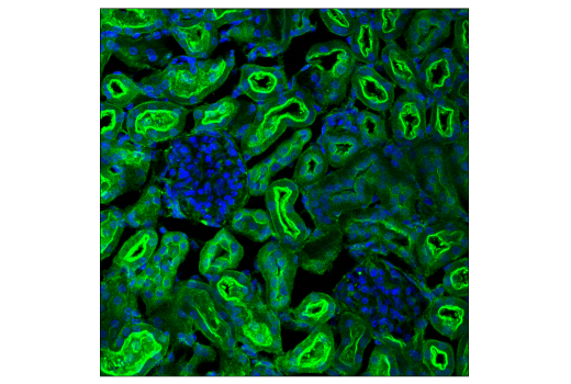  Image 31: PICALM Signaling Antibody Sampler Kit