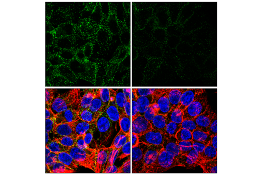 Immunofluorescence Image 5: PICALM (E3J9R) Rabbit mAb