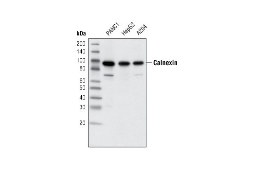 Western Blotting Image 1: Calnexin (C5C9) Rabbit mAb