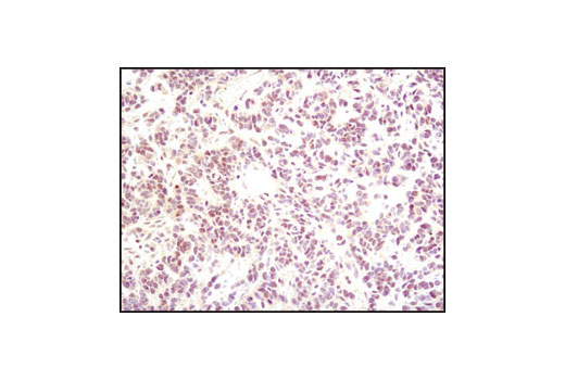 Immunohistochemistry Image 1: p35/25 (C64B10) Rabbit mAb