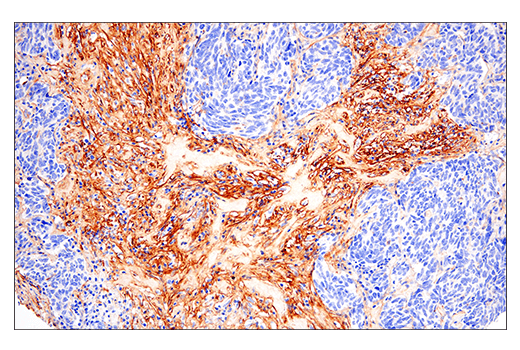  Image 25: Extracellular Matrix Dynamics Antibody Sampler Kit