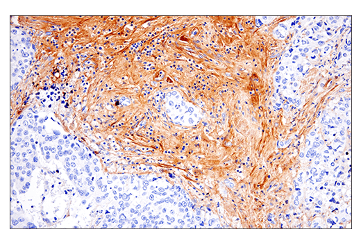  Image 39: Extracellular Matrix Dynamics Antibody Sampler Kit