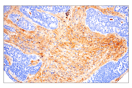  Image 50: Extracellular Matrix Dynamics Antibody Sampler Kit