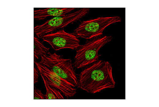 Immunofluorescence Image 1: Di-Methyl-Histone H3 (Lys36) (C75H12) Rabbit mAb (BSA and Azide Free)