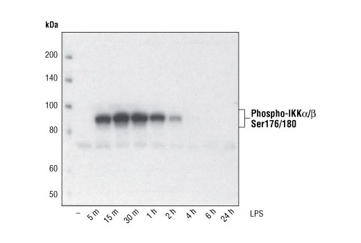  Image 7: NF-κB Pathway Antibody Sampler Kit II