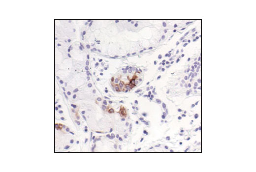  Image 36: NF-κB Pathway Antibody Sampler Kit II