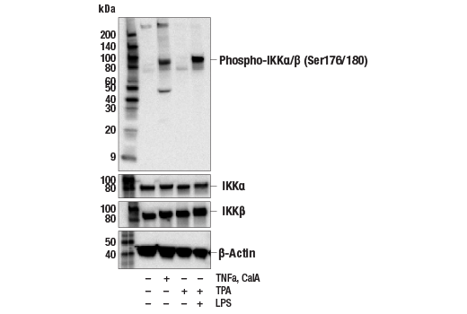  Image 14: NF-κB Pathway Antibody Sampler Kit