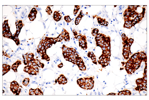 Immunohistochemistry Image 1: Pan-Keratin (5D3/LP34) Mouse mAb