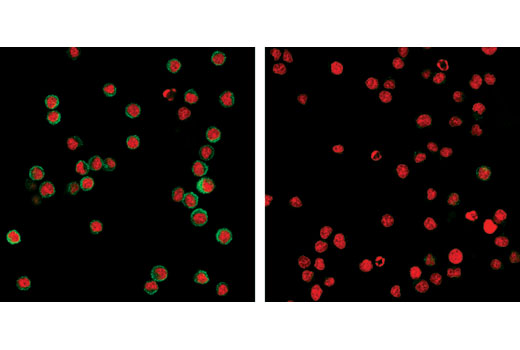 Immunofluorescence Image 1: Phospho-Zap-70 (Tyr319)/Syk (Tyr352) (65E4) Rabbit mAb