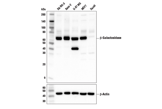 Western Blotting Image 1: β-Galactosidase (E2U2I) Rabbit mAb