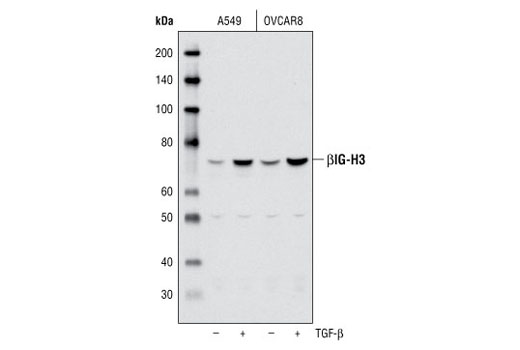 Western Blotting Image 1: βIG-H3 Antibody
