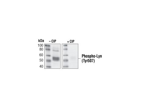 Western Blotting Image 1: Phospho-Lyn (Tyr507) Antibody