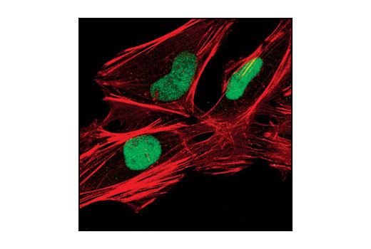 Immunofluorescence Image 1: XRCC1 Antibody