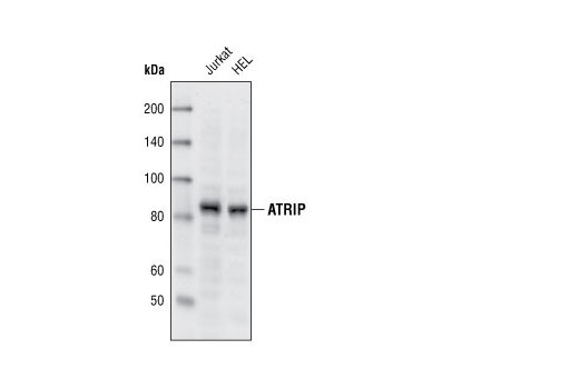 Western Blotting Image 1: ATRIP Antibody