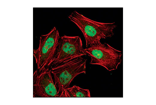 Immunofluorescence Image 1: ATRIP Antibody