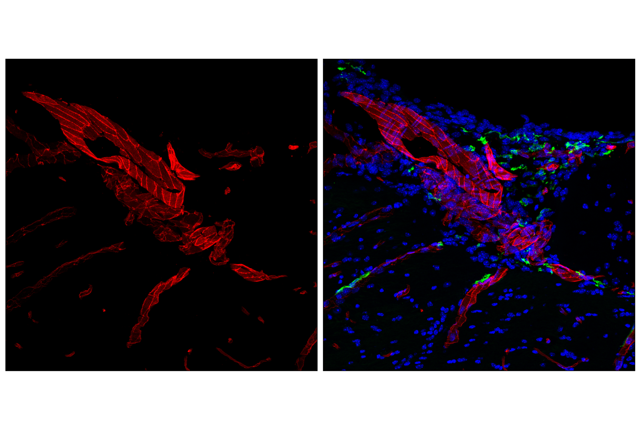 Immunofluorescence Image 3: CD31 (PECAM-1) (F2N3M) Rabbit mAb (Alexa Fluor<sup>®</sup> 555 Conjugate)