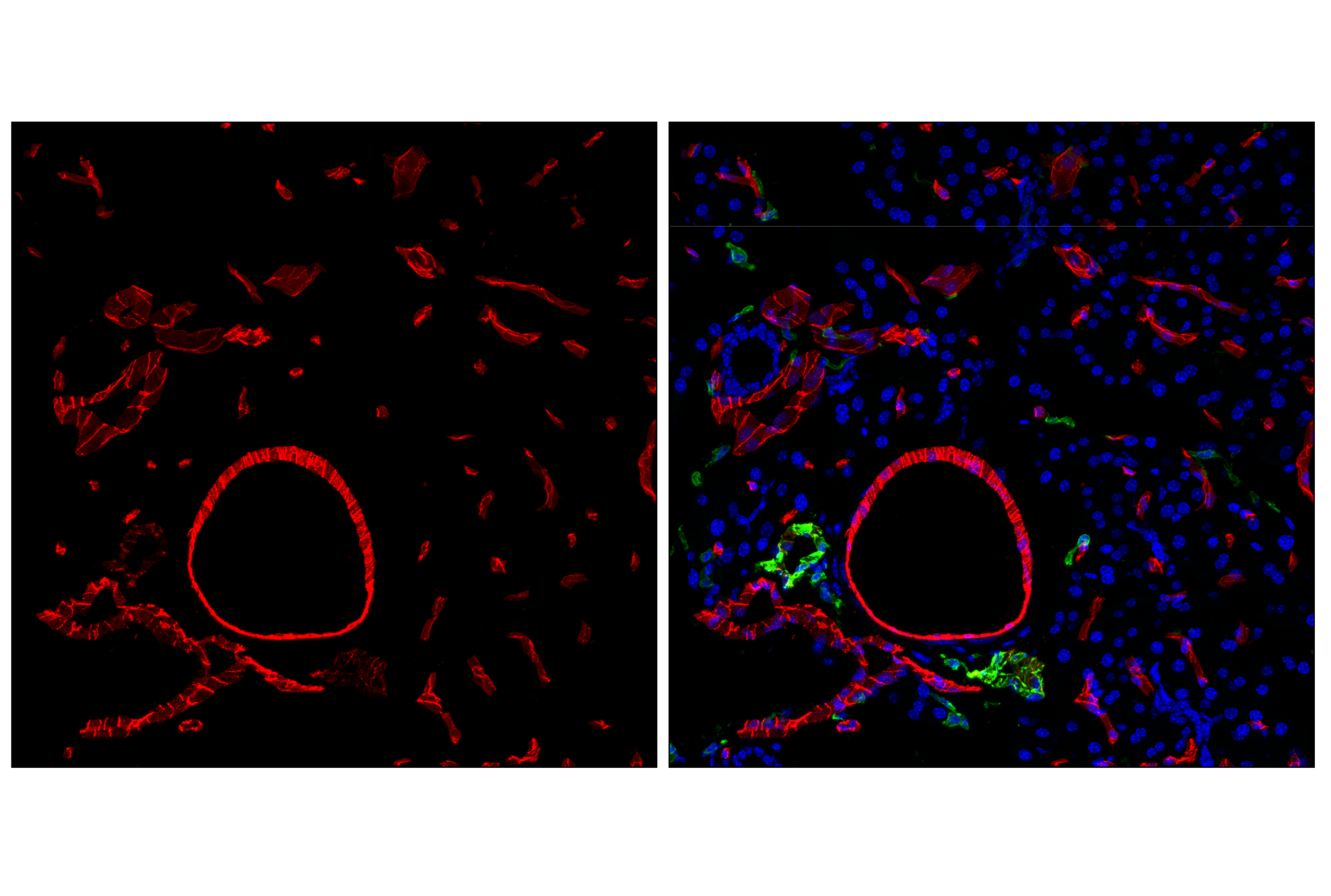 Immunofluorescence Image 2: CD31 (PECAM-1) (F2N3M) Rabbit mAb (Alexa Fluor<sup>®</sup> 555 Conjugate)