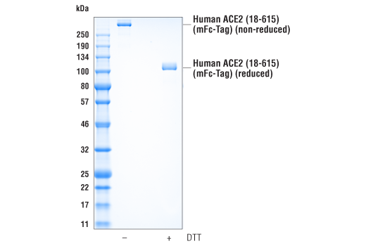  Image 1: Human ACE2 (18-615) Recombinant Protein (mFc-Tag)
