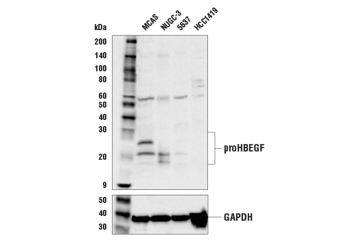  Image 3: Cancer-associated Growth Factor Antibody Sampler Kit