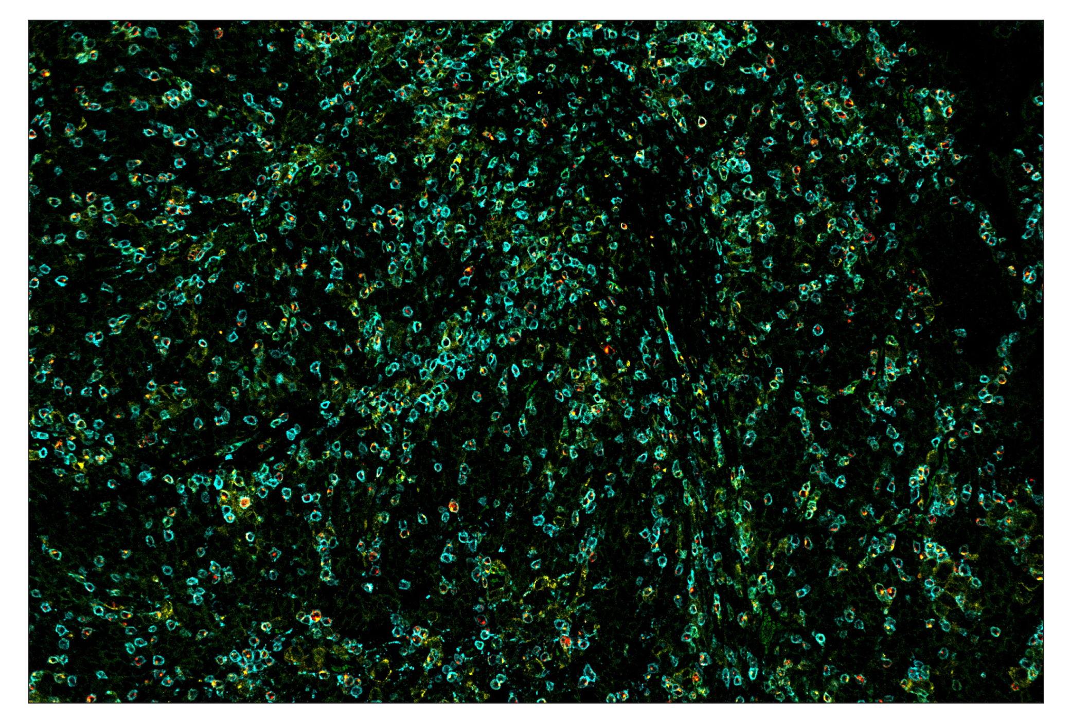 Immunohistochemistry Image 7: CD3ε (D7A6E™) & C0-0001-488 SignalStar™ Oligo-Antibody Pair