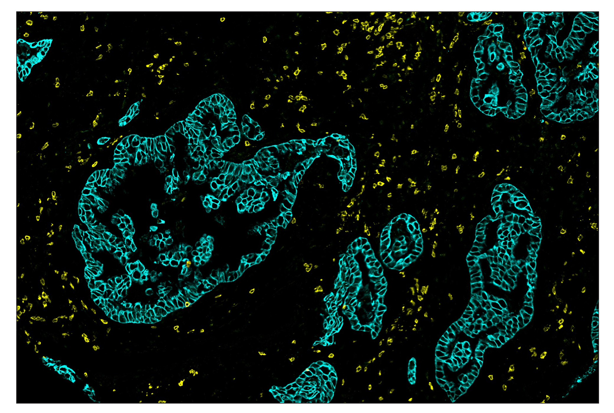 Immunohistochemistry Image 8: CD3ε (D7A6E™) & C0-0001-647 SignalStar™ Oligo-Antibody Pair