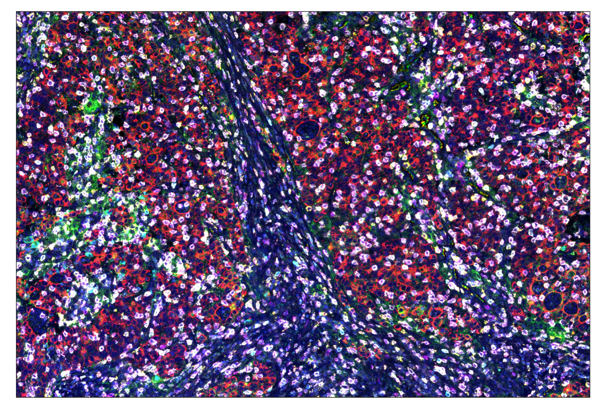 Immunohistochemistry Image 1: CD3ε (D7A6E™) & C0-0001-488 SignalStar™ Oligo-Antibody Pair