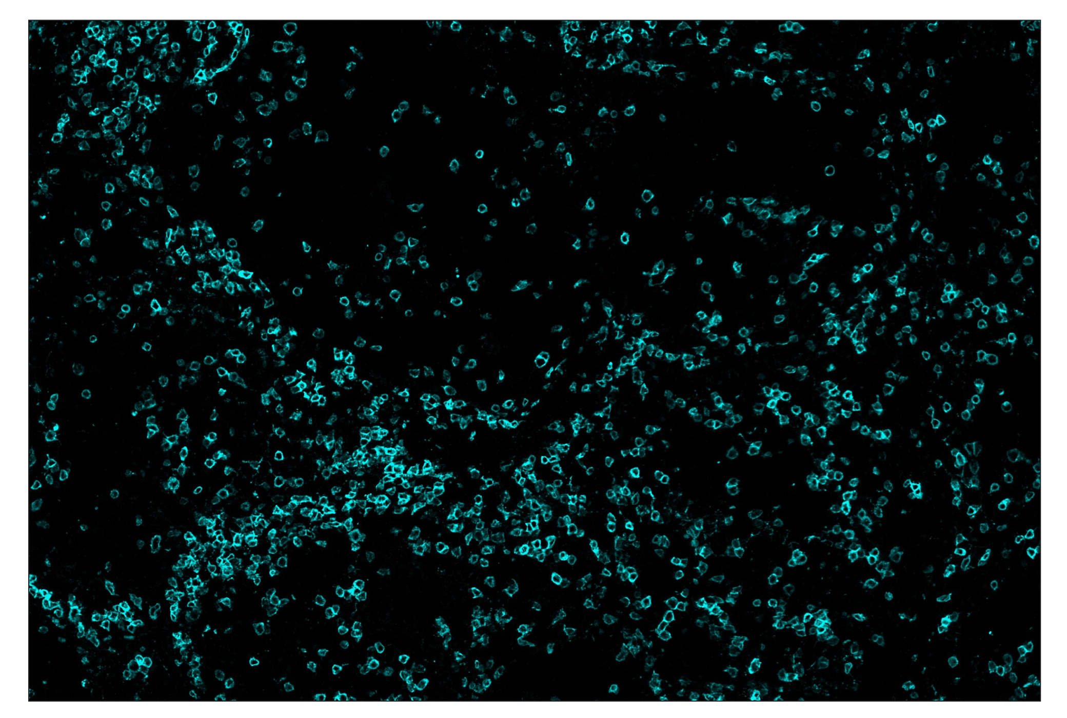 Immunohistochemistry Image 5: CD3ε (D7A6E™) & C0-0001-488 SignalStar™ Oligo-Antibody Pair