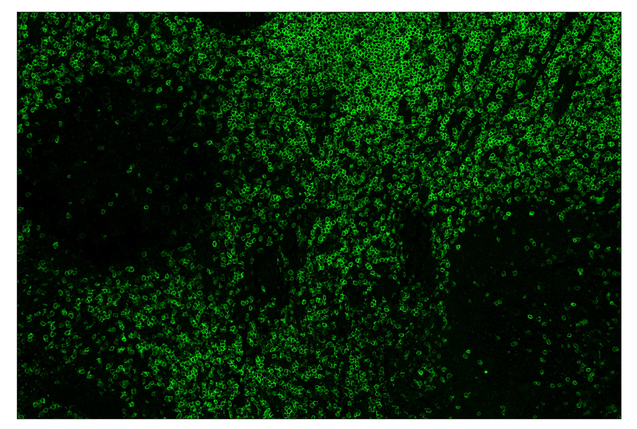 Immunohistochemistry Image 2: CD3ε (D7A6E™) & C0-0001-488 SignalStar™ Oligo-Antibody Pair
