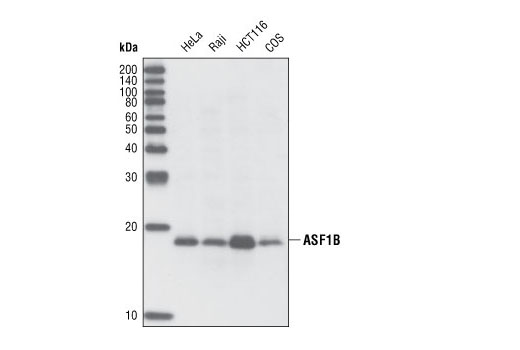 Western Blotting Image 1: ASF1B Antibody