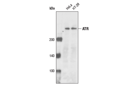 Western Blotting Image 1: ATR Antibody
