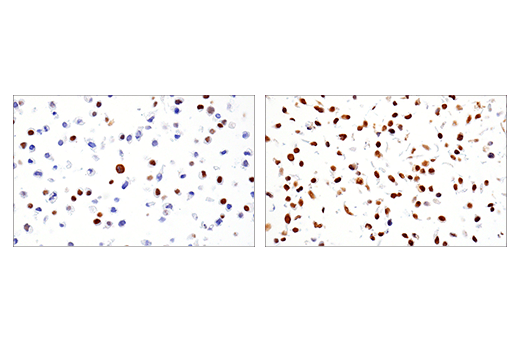 Immunohistochemistry Image 1: Phospho-ATF-2 (Thr71)/ATF-7 (Thr53) (E4A5G) XP®Rabbit mAb