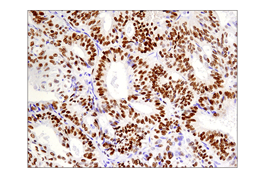 Immunohistochemistry Image 8: Phospho-ATF-2 (Thr71)/ATF-7 (Thr53) (E4A5G) XP® Rabbit mAb