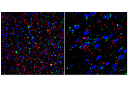 Immunofluorescence Image 1: LIMP-2/SCARB2 (E2Z5F) Rabbit mAb